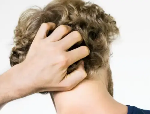 Prurito in testa: le cause dermatologiche più comuni e come intervenire