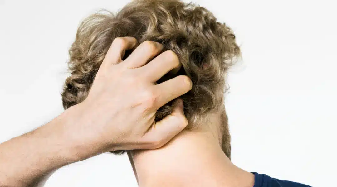 Prurito in testa | Galenia